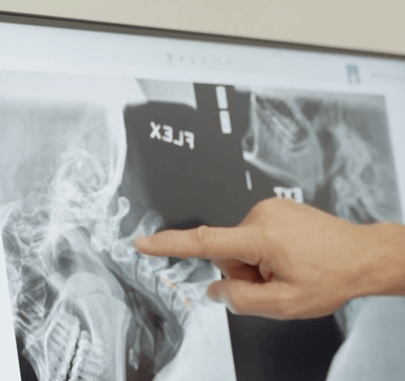 finger pointing at a x ray